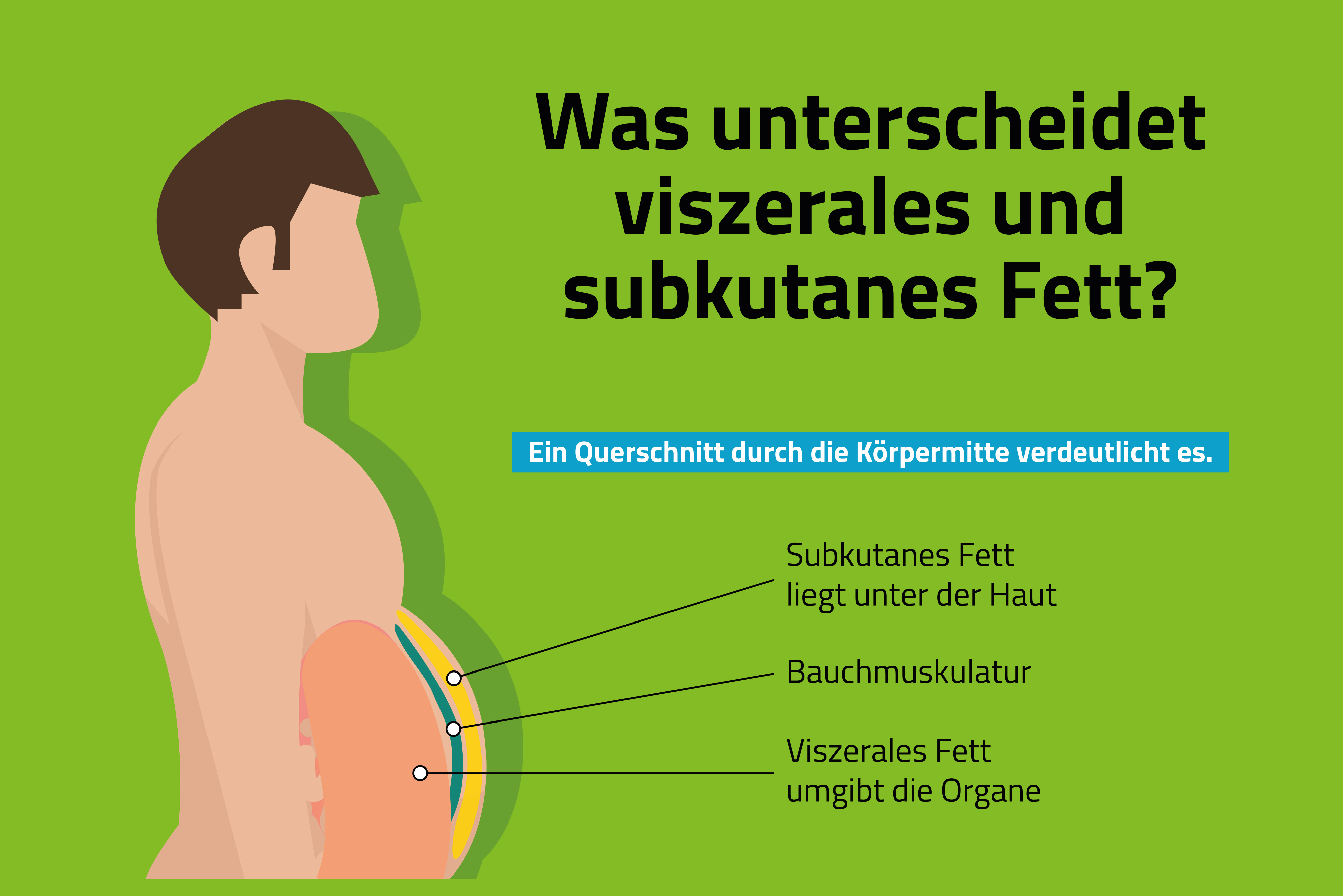 Grafik der Fettverteilung beim Menschen: Viszerales und subkutanes Fett