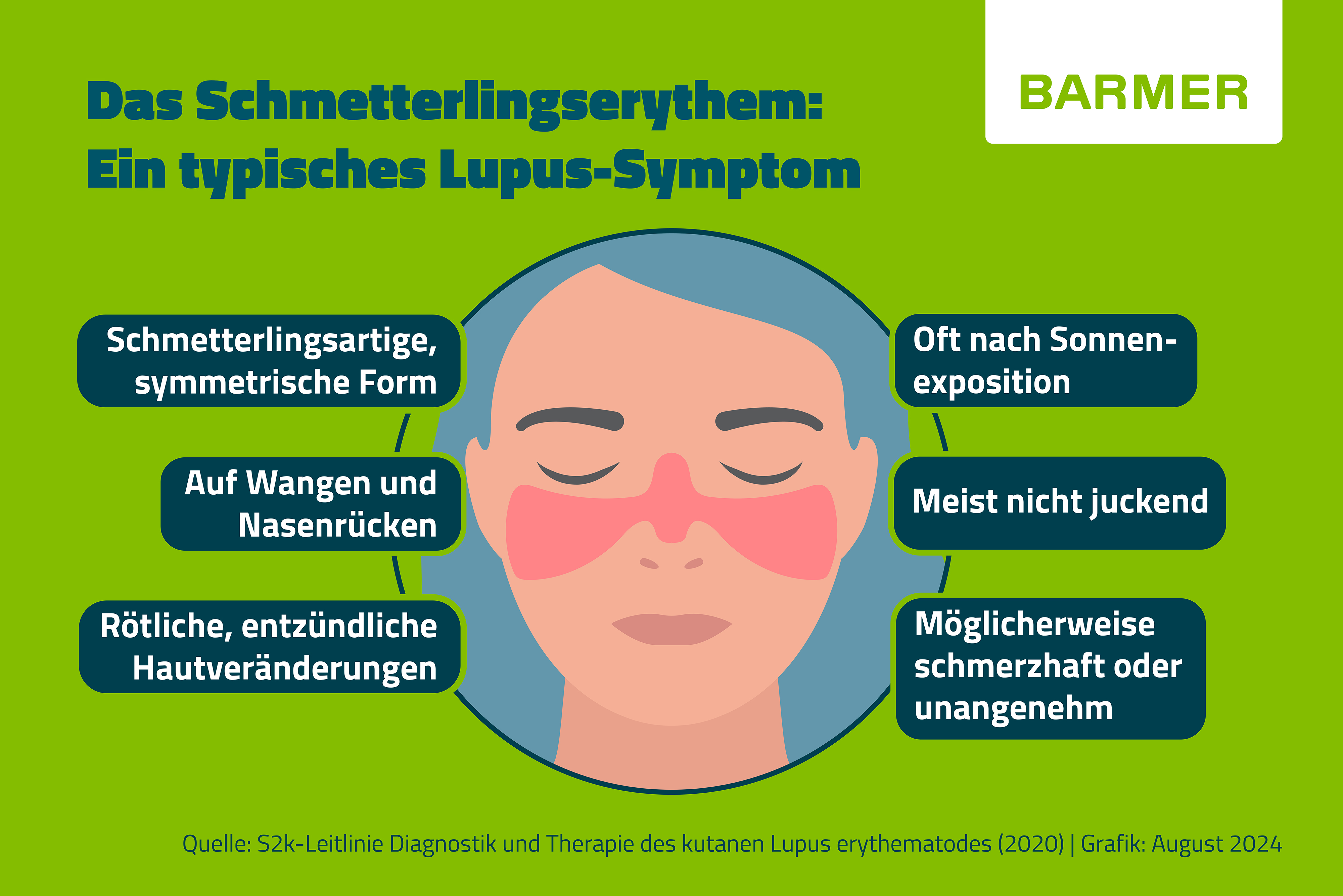 Infografik der BARMER zum Schmetterlingserythem als Lupus-Symptom: Rötlicher, schmetterlingsförmiger Ausschlag auf Wangen und Nasenrücken, oft nach Sonnenexposition. Weitere Merkmale: meist nicht juckend, kann schmerzhaft sein.