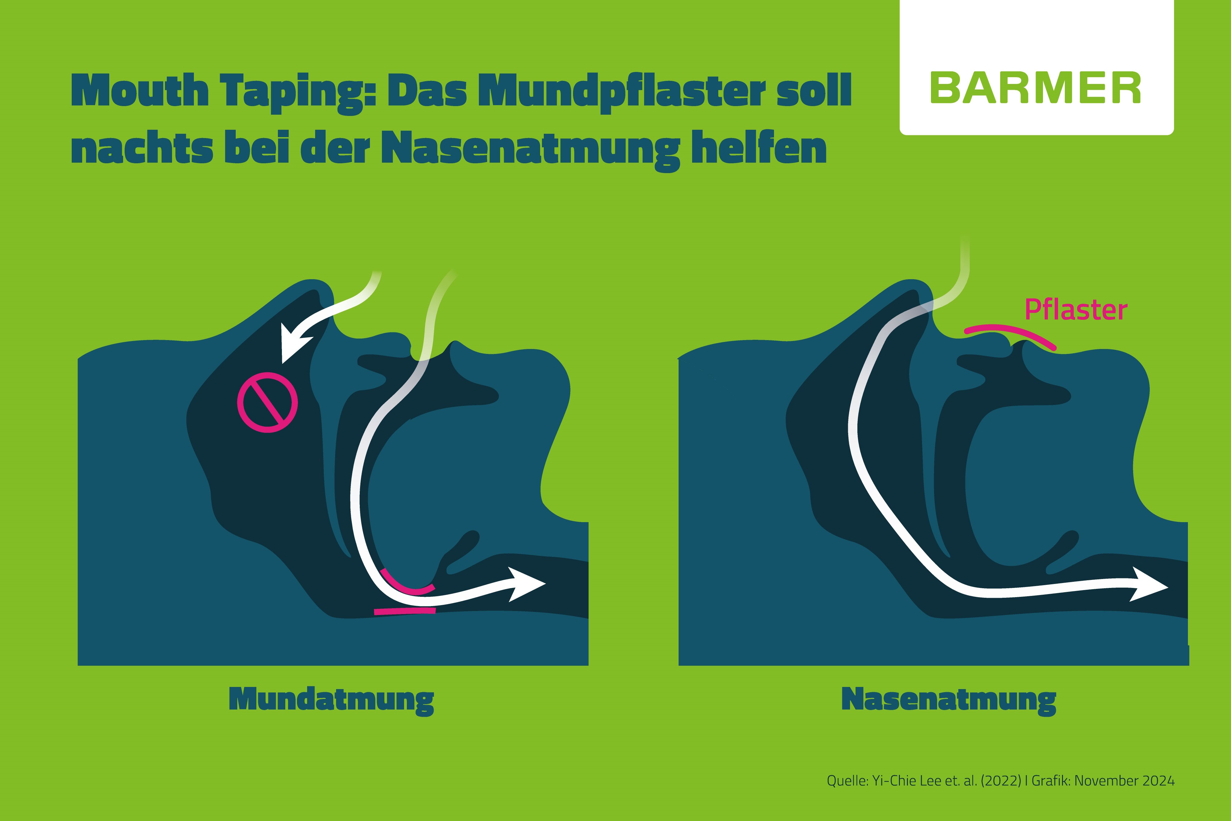 Mouth Taping: Ein über den Mund geklebtes Pflaster soll die Nasenatmung im Schlaf fördern.